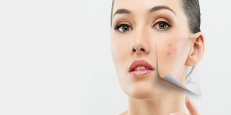 Cara Menghilangkan flek hitam di wajah