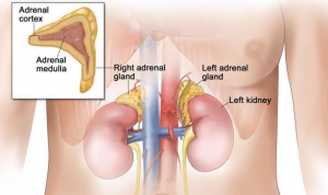 Penyakit Pheochromocytoma Adalah