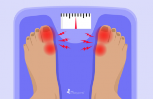 Kenaikan Berat Badan di Masa Dewasa Berisiko Lebih Besar Terkena Asam Urat