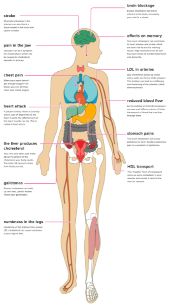 Efek Kolesterol Tinggi Pada Tubuh