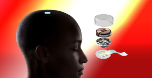 Elon Musk Menggandakan Klaim Bahwa Chip Otak Dapat Mengobati Obesitas yang Tidak Sehat