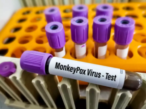 Saat gadis Ghaziabad dites negatif, berikut adalah gejala yang mengarah pada pengujian virus