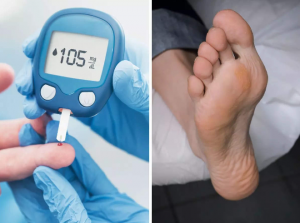 Tanda yang menunjukkan kadar gula darah tinggi