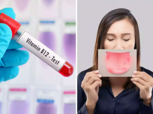 Waspadalah terhadap gejala-gejala ini yang mungkin muncul di lidah Anda