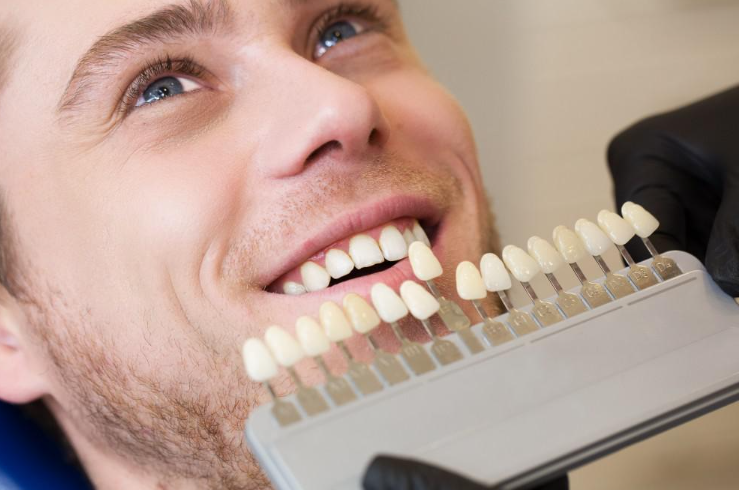 Bagaimana Implan Gigi Dapat Meningkatkan Kesehatan Mulut Anda?