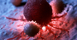 Gejala Umum Terjadi Pada 5 Jenis Kanker