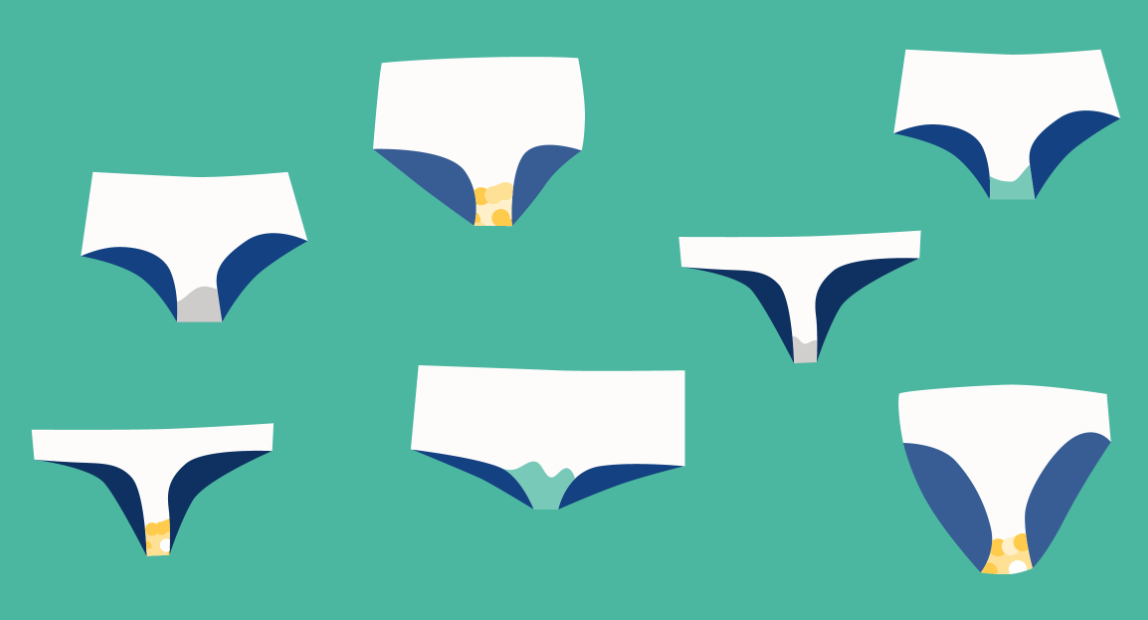 Keputihan: Bagaimana Mengetahui Apakah Itu Normal