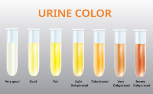 Warna Urin Dan Kandungan Di Dalamnya