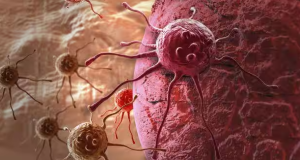 Tanda-tanda Awal Kanker Darah Yang Harus Anda Waspadai