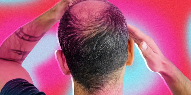 Menyisir Rambut yang Benar untuk Mencegah Kerontokan