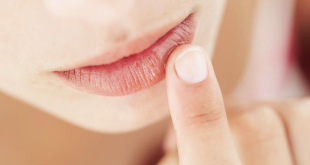 Cara Mencegah Bibir Kering dan Pecah-Pecah