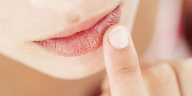 Cara Mencegah Bibir Kering dan Pecah-Pecah