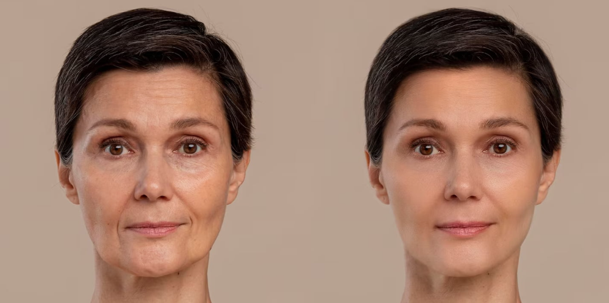 Cara Mudah untuk Melawan Penuaan Dini