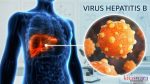 Cara Mengobati Hepatitis B